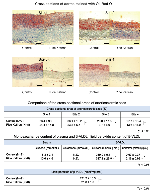 Anti-arteriosclerotic effect02