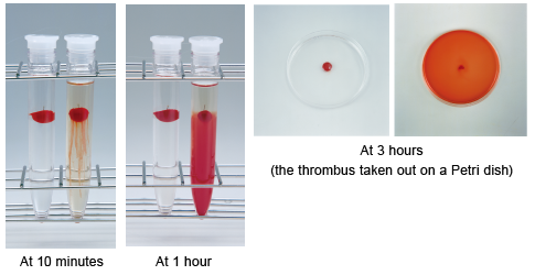 Thrombolytic effect of NKCP on artificial thrombi