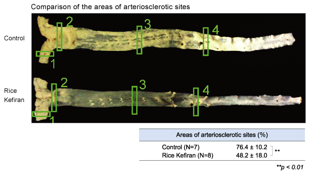 Anti-arteriosclerotic effect01