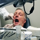 歯のクリーニングで健康管理