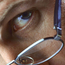 眼科の定期検診が見逃されている眼疾患の発見に有用
