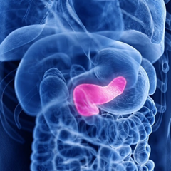 膵管拡張は膵臓がんの警告サイン